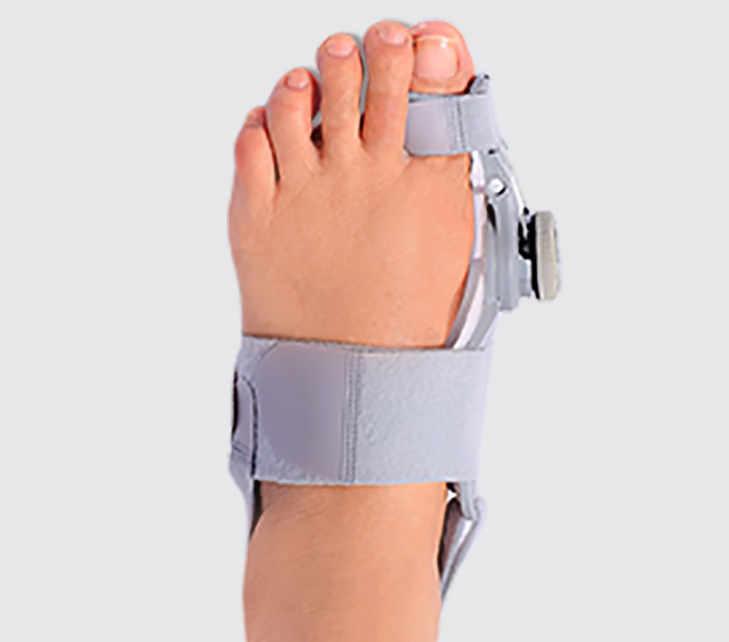 Solis Toewise — bunion corrector worn on the foot, top view, strap around the forefoot