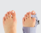 Solis Toewise — foot without and with the big toe splint